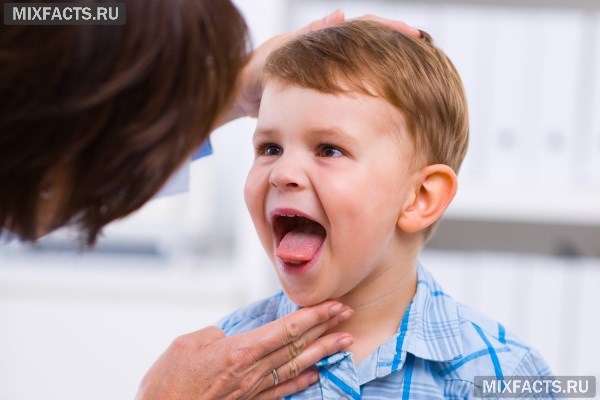 Причины появления белых пятен у ребенка на языке и их лечение  