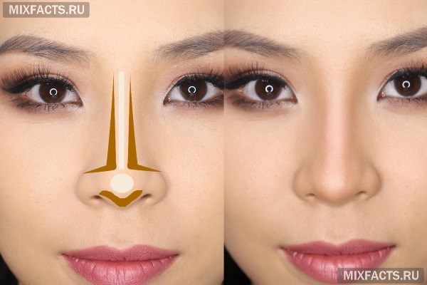 Как исправить нос картошкой – прическа, макияж, ринопластика 