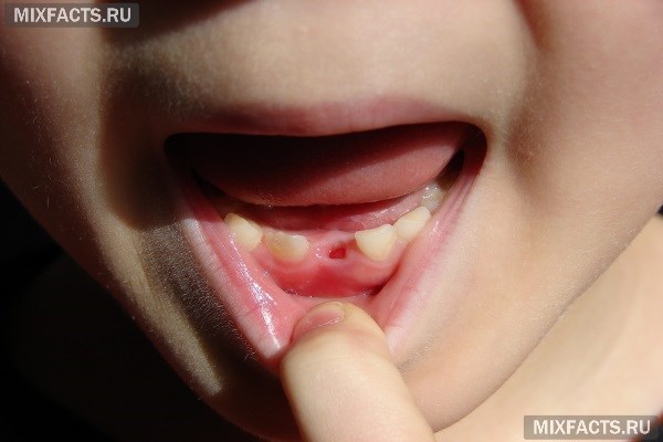 Когда выпадают зубы у детей? 