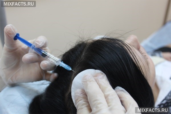 Мезотерапия для восстановления волос