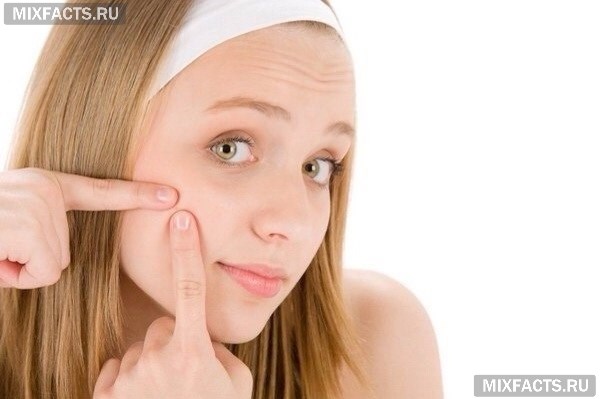 Способы лечения угрей на лице 