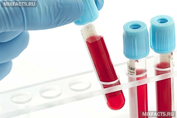 Агрегация тромбоцитов анализ крови при беременности thumbnail