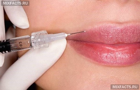 гиалуроновая кислота в губы